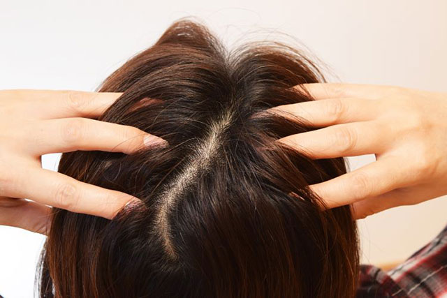 自然乾燥のデメリット（1）頭皮や髪に雑菌が増える