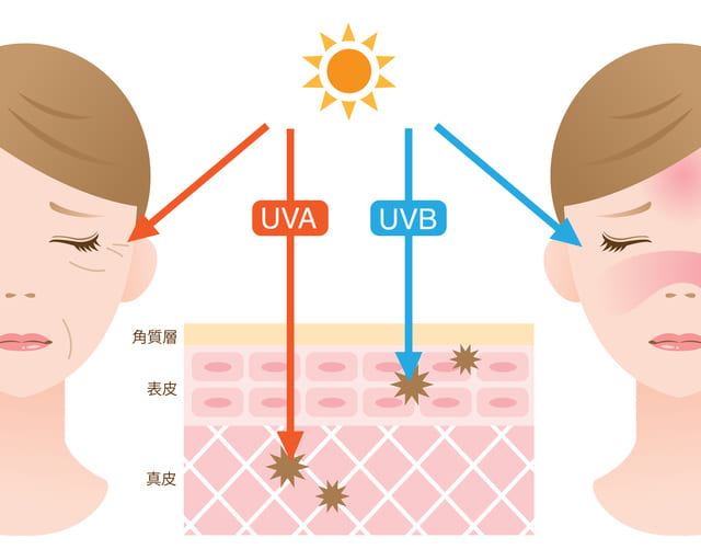 紫外線の種類「UVA」「UVB」とは？
